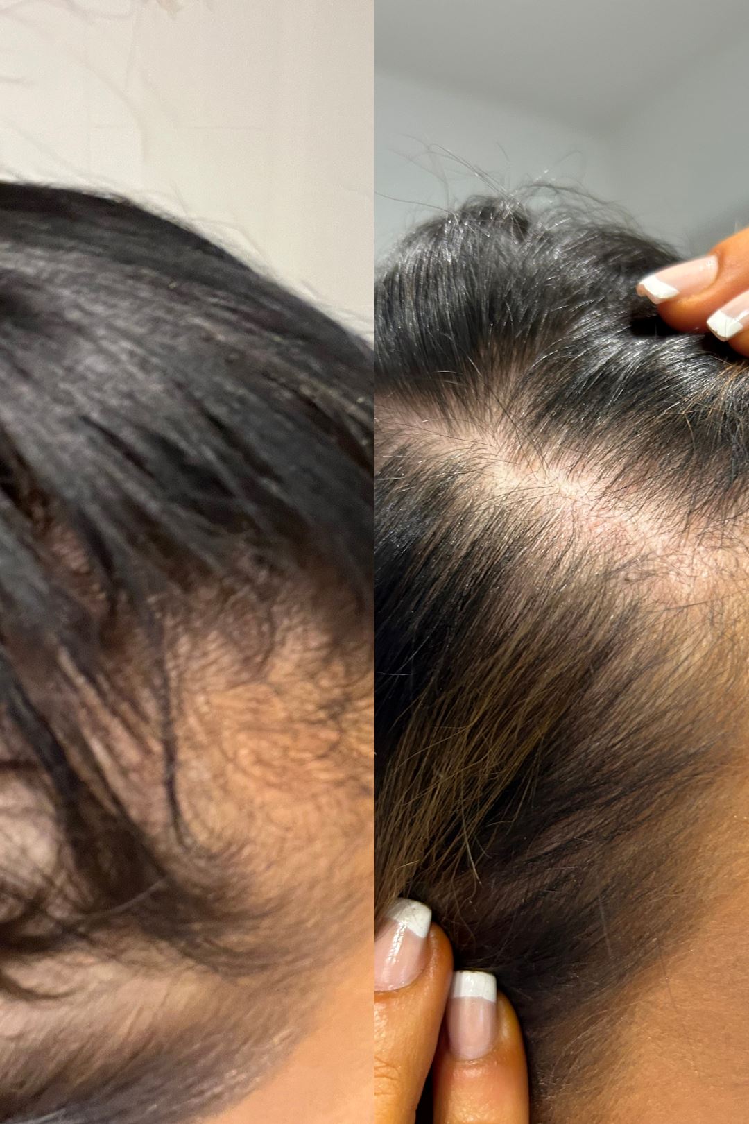 Shampooing Gloss pour la croissance des cheveux - Format voyage