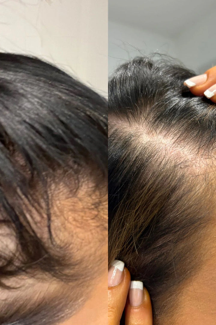 Complete Hair Growth System